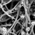 Dr-Balaji-Bone-cells-in-fibres