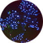 cardiotoxcicity