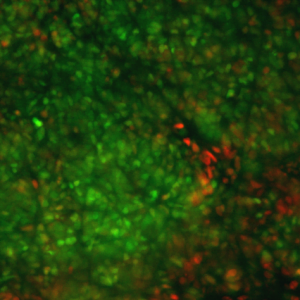 neuraldiff2