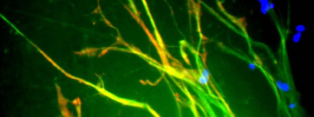 neurite-outgrowth