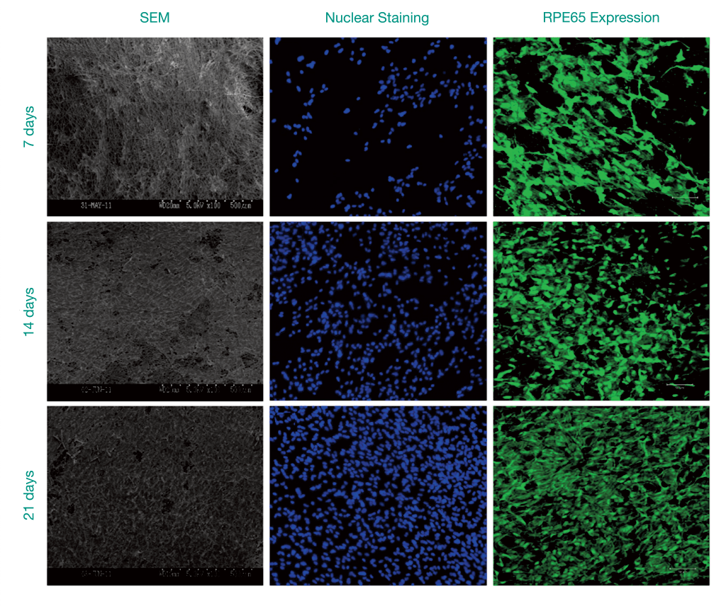 Retinal-epithelial-cells-Ulster-1024x859-1024x859